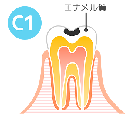 c1