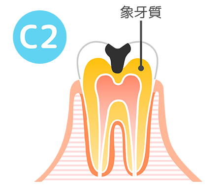 c2