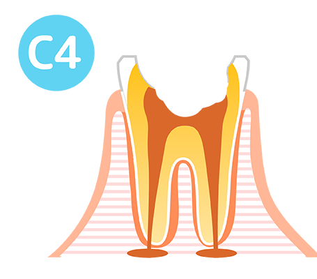c4